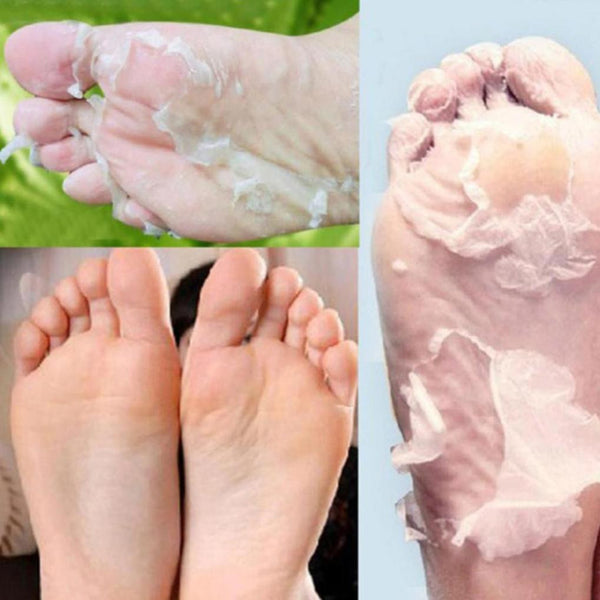 Papaya Hot Remove Dead Skin Foot Mask Peeling Cuticles Heel Feet Care Anti Aging